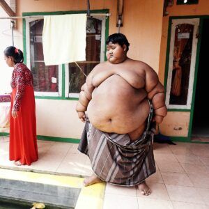 Džambik Chatochov - Nejtlustší muž světa